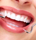 טיפולי שיניים אסתטיים: חיוך יפה יותר על בסיס השיניים הטבעיות-תמונה